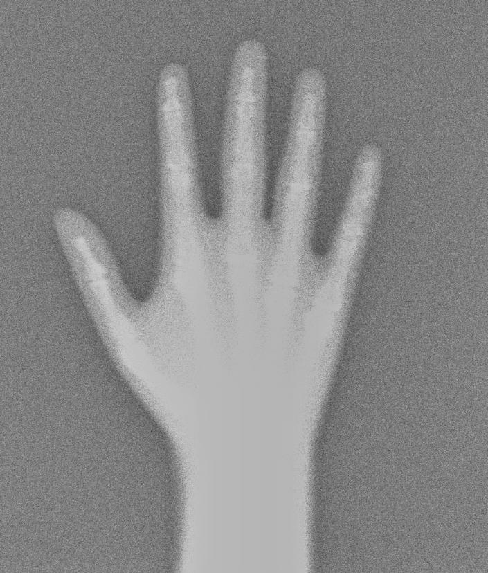 Hand X-Ray #2
