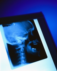 scull x-ray
