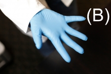 Exam Glove: Shown as too tight for the medical staff