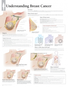 Understanding Breast Cancer Chart