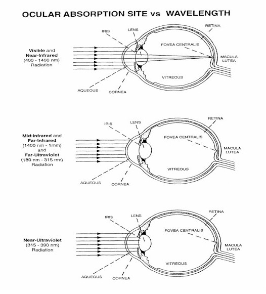 Laser Safety Glasses The Ugly Truth About Laser Radiation Exposure