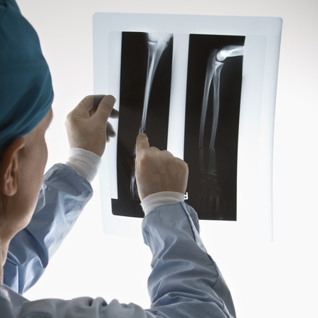 Doctor examining an x-ray