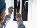 Doctor examining an x-ray
