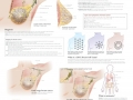 Understanding Breast Cancer Chart